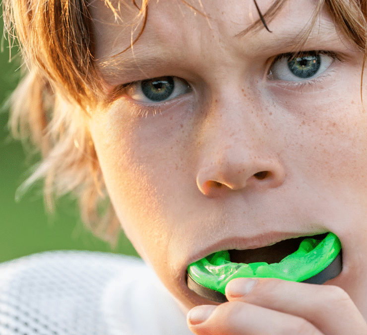 Please Protect Your Teeth – The Importance of Mouth Guards during Covid-19