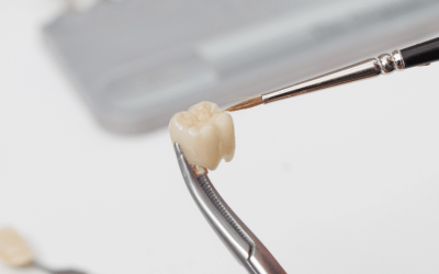 My Crown fell out! What should I do?