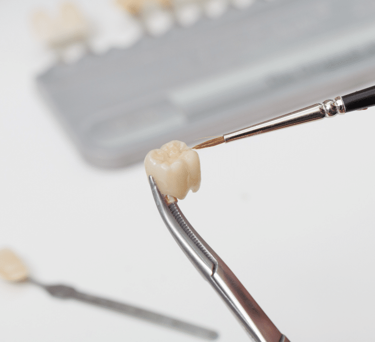 My Crown fell out! What should I do?