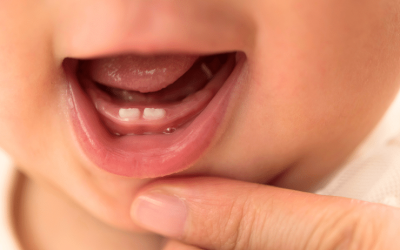 5 Things Parents Should Know About Baby Teeth