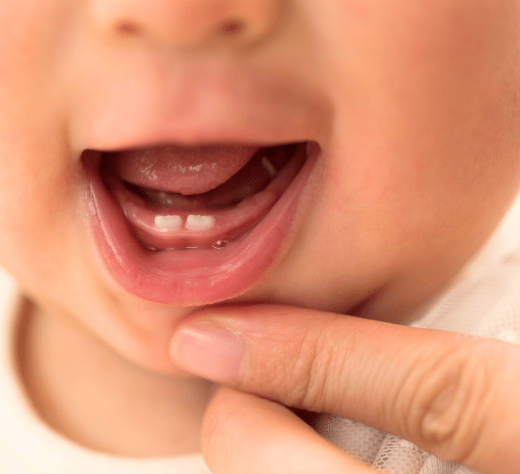 5 Things Parents Should Know About Baby Teeth