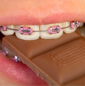 Candy and orthodontics