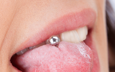 Beyond the Bling: Navigating Tongue Piercings and Oral Wellness