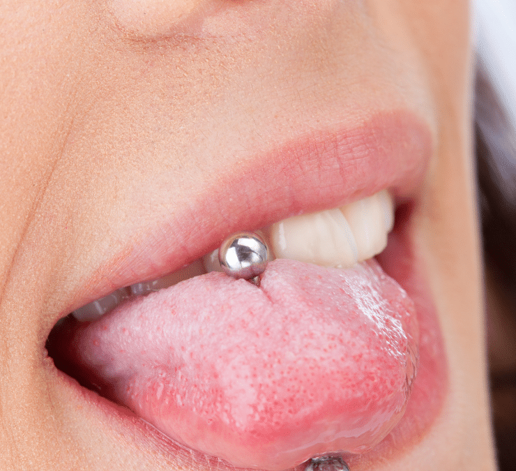 Beyond the Bling: Navigating Tongue Piercings and Oral Wellness